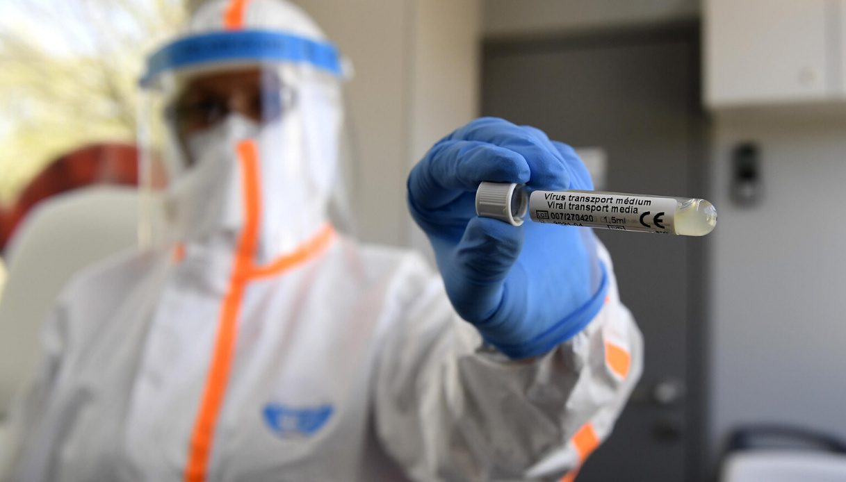 test-sierologici-coronavirus